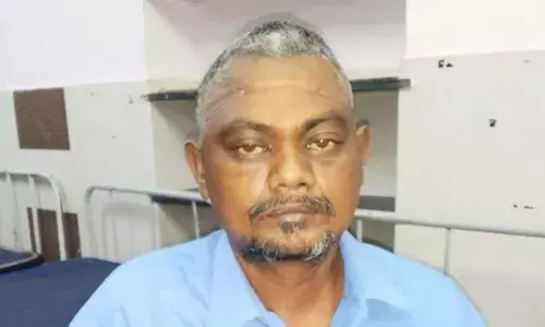 சேலம் அரசு மருத்துவமனையில் மூளையில் இருந்த கருப்பு பூஞ்சை அகற்றி சாதனை