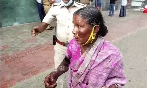 மனைவியின் நடத்தையில் சந்தேகப்பட்டு ஆசிட் வீசிய கணவனுக்கு வலை வீச்சு