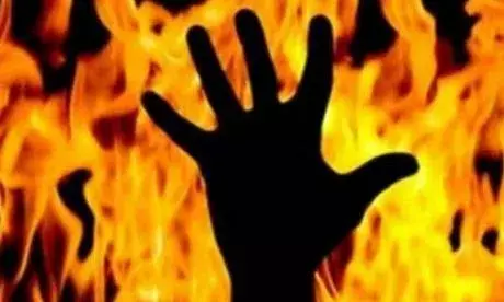 முதல்வர் ஸ்டாலின் வீட்டின் அருகே தீக்குளித்தவரால் பரபரப்பு