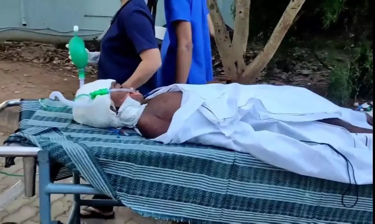 4 மணி நேர சிகிச்சைக்கு பின் சிறுவன் தலையில் துப்பாக்கி குண்டு அகற்றம் 4 மணி நேர சிகிச்சைக்கு பின் சிறுவன் தலையில் துப்பாக்கி குண்டு அகற்றம்