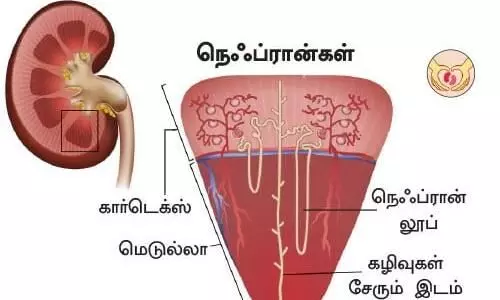 சிறுநீர்த் தொற்று பெண்களைத் தான் அதிகம் பாதிக்கும்..! எப்படி பாதுகாக்கலாம்..? சிறுநீர்த் தொற்று பெண்களைத் தான் அதிகம் பாதிக்கும்..! எப்படி பாதுகாக்கலாம்..?