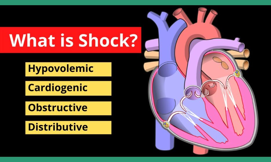 shock-meaning-in-tamil