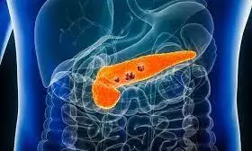 Pancreatic Cancer-கணைய புற்று ஏன் வருகிறது? தடுப்பது எப்படி? Pancreatic Cancer-கணைய புற்று ஏன் வருகிறது? தடுப்பது எப்படி?