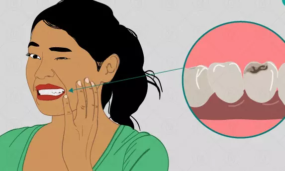Tooth decay remedies - பல் சிதைவை தடுப்பதற்கான வீட்டு வைத்திய முறைகள் தெரிஞ்சுக்குங்க! Tooth decay remedies - பல் சிதைவை தடுப்பதற்கான வீட்டு வைத்திய முறைகள் தெரிஞ்சுக்குங்க!