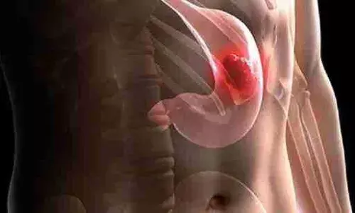 Stomach Cancer Symptoms in Tamil-இரைப்பை புற்று இருந்தால் என்ன அறிகுறிகள் காட்டும்..? தெரிஞ்சுக்கங்க..! Stomach Cancer Symptoms in Tamil-இரைப்பை புற்று இருந்தால் என்ன அறிகுறிகள் காட்டும்..? தெரிஞ்சுக்கங்க..!
