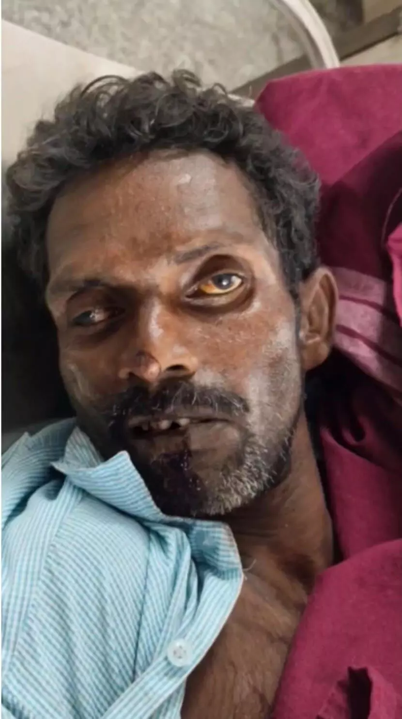 சிகிச்சை பெற்று வந்த நோயாளி மாடியில் இருந்து குதித்து உயிரிழப்பு சிகிச்சை பெற்று வந்த நோயாளி மாடியில் இருந்து குதித்து உயிரிழப்பு