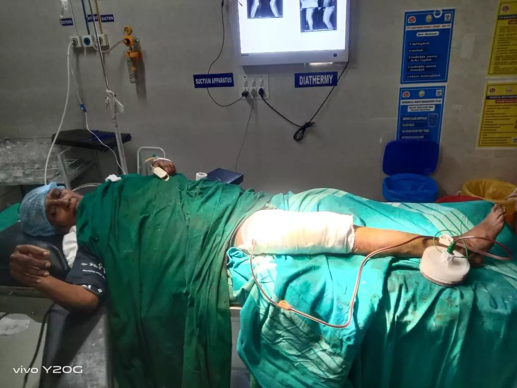 91 வயது மூதாட்டிக்கு உயர்தர அறுவை சிகிச்சை: தென்காசி அரசு மருத்துவர்கள் சாதனை 91 வயது மூதாட்டிக்கு உயர்தர அறுவை சிகிச்சை: தென்காசி அரசு மருத்துவர்கள் சாதனை