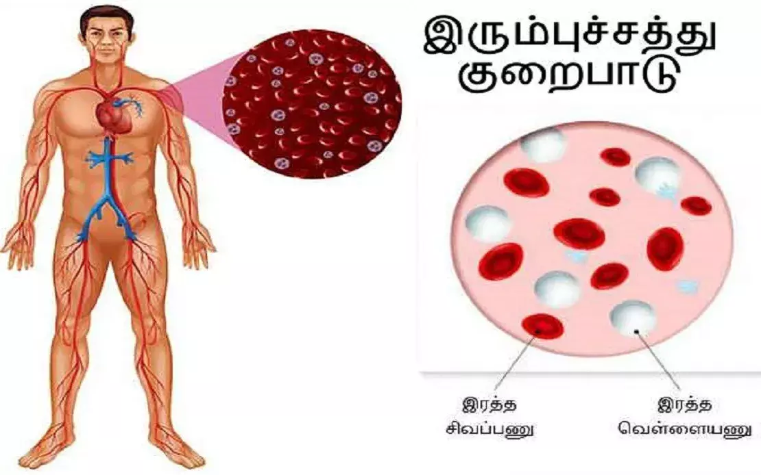 இரும்பு சத்து குறைபாட்டால் உடலுக்கு ஏற்படும் பாதிப்புகள்; இதுல ரொம்ப கவனமாக இருங்க! இரும்பு சத்து குறைபாட்டால் உடலுக்கு ஏற்படும் பாதிப்புகள்; இதுல ரொம்ப கவனமாக இருங்க!