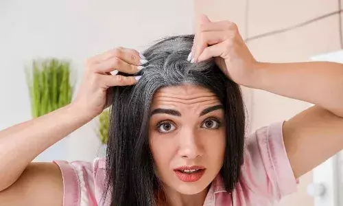 மன அழுத்தம் முடியை நரைக்கச் செய்யுமா..? வாங்க பார்க்கலாம்..!