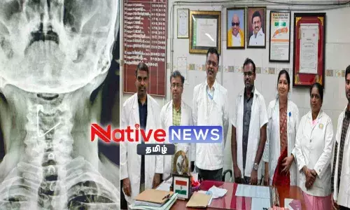 ஈரோடு அரசு தலைமை மருத்துவமனையில் தொழிலாளியின் தொண்டையில் சிக்கிய சேப்டி பின் அகற்றம்! ஈரோடு அரசு தலைமை மருத்துவமனையில் தொழிலாளியின் தொண்டையில் சிக்கிய சேப்டி பின் அகற்றம்!